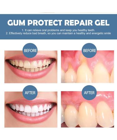 GNAUMORE Gum Repair Gel for recovery and repair gum repair repair gel for gums natural formula 3 pieces - Buy Online on GoSupps.com