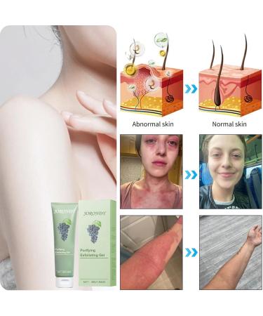 JORONDY Purifying Exfoliating Gel Exfoliating Scrub with Cabernet Sauvignon Extract Gentle Exfoliator for All Skin Types Deep Cleansing and Moisturizing Gel for Face and Body - Buy Online on GoSupps.com