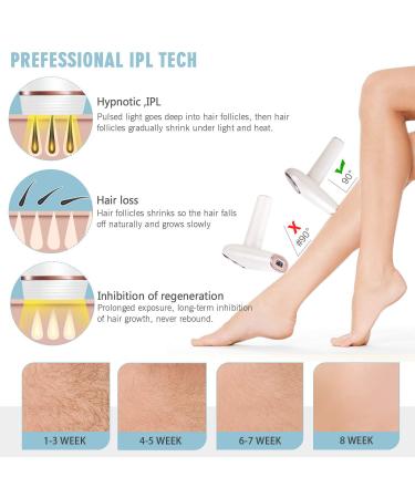 Permanent Hair Removal System with ICE Cooling Technology - Home Use Laser Hair Remover for Women and Men (Rose Pink) - Buy Online on GoSupps.com