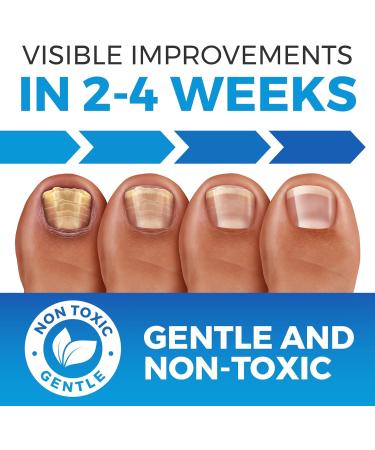 White Nail Mycosis Combo - Fast & Effective Solution - Buy Online on GoSupps.com