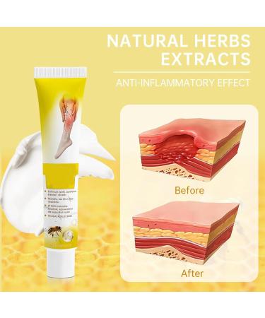  ALLILUYAA Zoencgz Pack of 2 Bee Poison Creams - Bee Venom and Varicose Veins - Buy Online on GoSupps.com