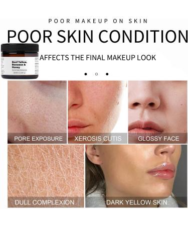 WINONDE Honey tallow balm beef tallow and honey moisturizer nourishing face and body cream moisturizing cream for dry skin - Buy Online on GoSupps.com