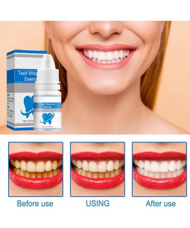 Buy 2pcs Teeth Brightening Liquid Improve Yellow Teeth & Clean Skin | 20ml Perfume PARFUM - Buy Online on GoSupps.com