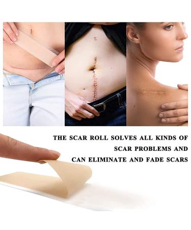 Medical Grade Silicone Scar Sheets - 1.6x120 Inch (7 Month Supply) for Surgery, C-section, Keloid & Burn - Safe & Painless Scar Removal - Buy Online on GoSupps.com