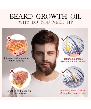 Beard Butter for Men - Natural Mustache Balm & Hair Growth Formula | Vesone 0.68 oz - Buy Online on GoSupps.com
