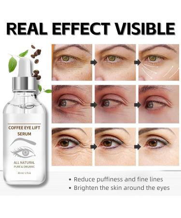 Caffeine Eye Serum for Dark Circles Organic Caffeine Eye Lifting Serum Anti Aging Under Eye Serum Caffeine Eye Cream for Dark Circles and Puffy Eyes Skincare Anti Wrinkle Eye Bag Removal - Buy Online on GoSupps.com