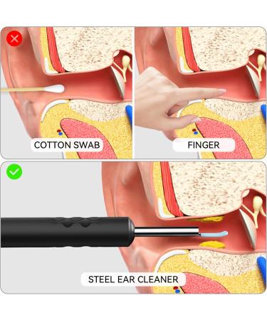 Ear Wax Removal Smart Visual Ear Cleaner with Otoscope 1296P HD Camera 6 LED Light Cleaning Earwax Remover Tool with Multi Replacement Tips Ear Cleaner B - Buy Online on GoSupps.com