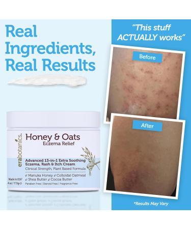 Eczema Cream with Manuka Honey & Colloidal Oatmeal Extra Strength Anti Itch Cream for Dry Sensitive Skin Dermatitis & Itchy Skin Relief Moisturizer for Adults & Kids Steroid Free Face & Body Use - Buy Online on GoSupps.com