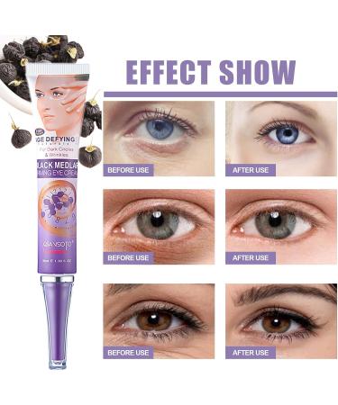 Black Medlar Eye Cream Firming Eye Cream Anti Aging Korean Eye Cream For Dark Circles And Puffy Eyes Diminishing Deep Wrinkles Under Eye Cream Hydrating Eye Cream For Men And Women 30ml - Buy Online on GoSupps.com