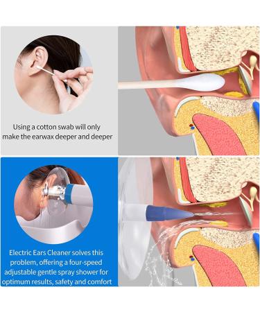 Rechargeable Electric Ear Wax Remover with 4 Pressure Levels and 5 Disposable Tips - Buy Online on GoSupps.com