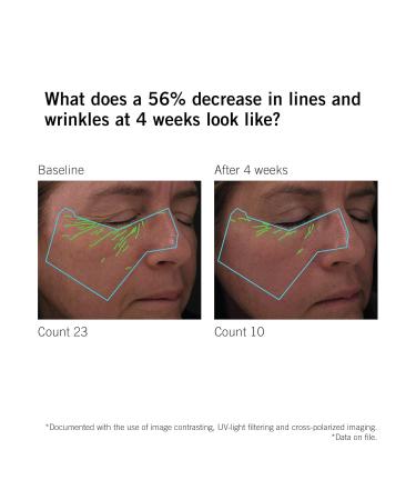 NEOVA SmartSkincare DNA Total Repair Serum 30 mL 1 fl. Oz. | Reduces Wrinkles Uneven Texture & Hyperpigmentation | Sun Damage Repair Serum - Buy Online on GoSupps.com