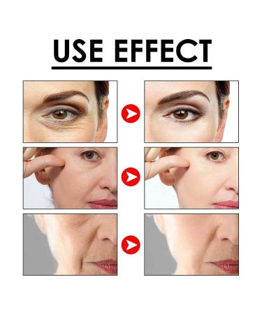 Lazzmonk 3Pcs Lumilight Eye Cream Set for Wrinkle-Free Eyes | Vshell & Shell Anti-Wrinkle Formula - Buy Online on GoSupps.com