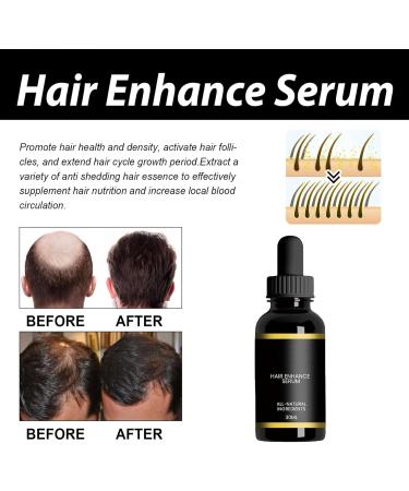 Hair Growth Oil | Dry Scalp Oil | Natural Nourishing Cold Pressed Moisturizing Organic Rosemary Oil 1.62oz for Hair Loss Promotes Zonto - Buy Online on GoSupps.com