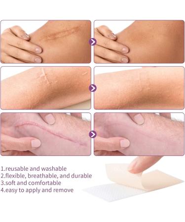 MQUPIN Silicone Scar Tape Roll (1.6 x 60 ) Silicone Scar Sheets Silicone Tape Reusable for C-Section Surgical Scar Keloid Acne Scar and Burn Scar - Buy Online on GoSupps.com