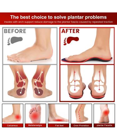Plantar Fasciitis Insoles for 240+ lbs | Arch Support Orthotic Inserts for Men & Women | Heavy Duty Support for Flat Feet & All-Day Comfort - Buy Online on GoSupps.com