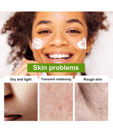 98% Organic Aloe Vera Moisturizer Facial Cream | Anti-Wrinkle & Hydrating for Dry Skin & Acne Scars - Buy Online on GoSupps.com