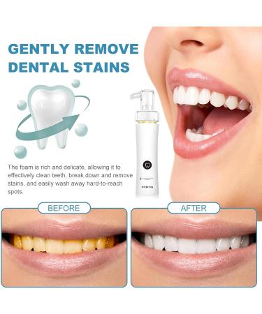 Renh Artisan Fluoride-Free Toothpaste: Probiotic Gum Protection & Fast Lightening (3-Pack) - Caries Protection & Restoration - Buy Online on GoSupps.com