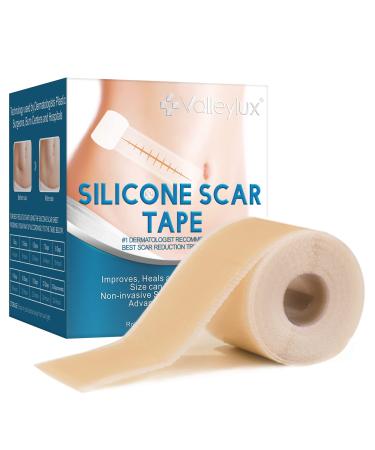 Silicone Scar Sheets(1.6'' x 60'') Reusable Silicone Scar Tape Medical Grade Silicone Scar Strips Painless Easy Scar Removal - Surgery C-section Burns Acne Keloid Easy-Tear Soft Scar Tape 1 Nude(1.6'' x 60'')
