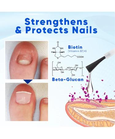 Onyxoguard Nail Growth & Repair Serum | Strengthen Brittle Nails | 5PC Onycholysisheal Conditioner - Buy Online on GoSupps.com
