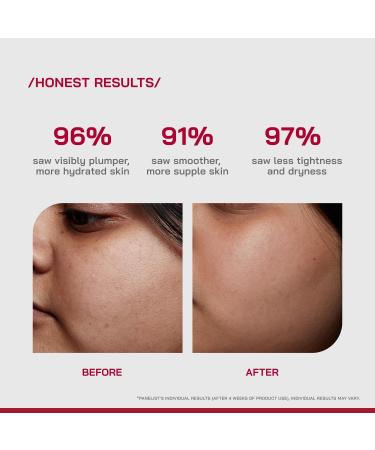 /PHD/ 2% Hyaluronic Acid Dewy Skin Serum | Hyaluronic Acid Face Serum for Dehydrated Dull & Dry Skin | Hydrating Face Serum with PGA & Panthenol | Deep Hydration & Dewy Finish | Lightweight | 30ml - Buy Online on GoSupps.com
