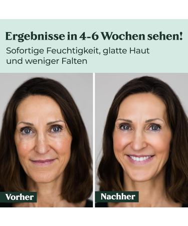 Auirshiky Antipimple face cream facial moisturizer facial care antiaging cream antiwrinkle cream antiwrinkle with niacinamide hyaluron for all skin types 50 ml - Buy Online on GoSupps.com