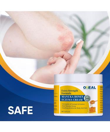 Manuka Honey Eczema Cream - Tinea Treatment for Athletes Foot Ringworm & Psoriasis - 3.4 oz Relief for Dry Skin & Dermatitis - Buy Online on GoSupps.com