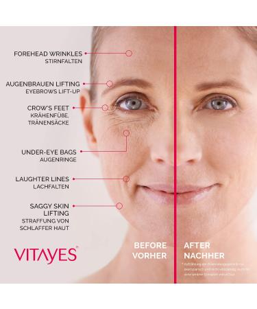VITAYES Instant Ageback Ageless Facelift Cream - Under Eye Bag Removal, Dark Circles & Fine Lines - 7ml Tube - Buy Online on GoSupps.com