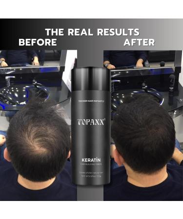Hair Building Fibers 2-in-1 Kit - Thickening Fibers & Spray Applicator for Men & Women | Conceal Thinning Hair (Dark Brown - Buy Online on GoSupps.com