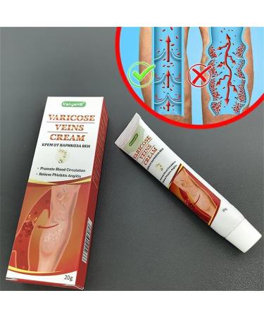 3-Piece Kanyehb Varicose Vein Relief Cream | Effective Treatment for Varicose Veins on Legs & Broom Travelers - Buy Online on GoSupps.com