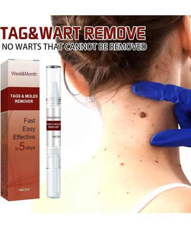 Liqui Skin Removal Wipe Off Tags And Moles Skin Mole Remover LiquiNatural Non-Irritating Mole Pen Wart Repair Pen - Buy Online on GoSupps.com