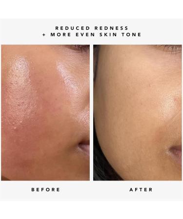 HERBIVORE Brightening + Smoothing Duo | Nova Serum & Moon Fruit Serum for Radiant Skin - Buy Internationally - Buy Online on GoSupps.com