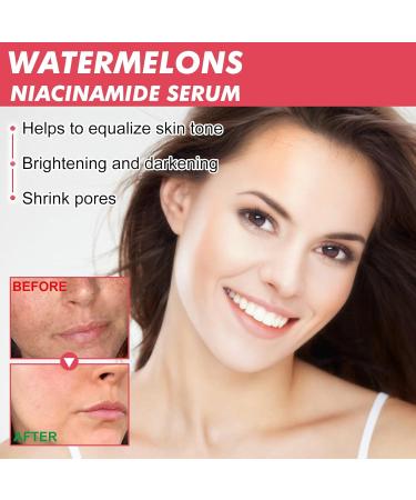 Skincare Set Skin Care Women Watermelon Niacinamide Skin Care Set For Teenage Girls - Watermelon Serum and Sleeping Mask - Deep Hydration Skin Care Sets & Kits - Buy Online on GoSupps.com