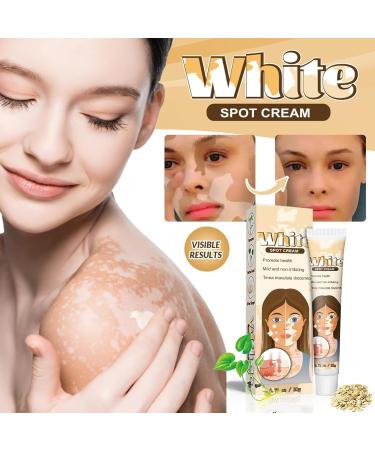 2pack White Spot Cream Vitiligo Skin Care Balm Skin Therapy Cream Moisturizing Regenerates skin pigmentation suitable for men and women - Buy Online on GoSupps.com