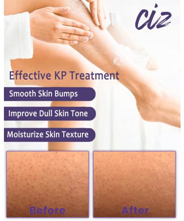 KP Bump Eraser Body Scrub - Plant-Based Exfoliating Treatment for Keratosis Pilaris & Strawberry Legs - Buy Online on GoSupps.com