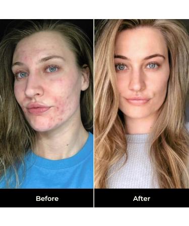 Golden Secrets Youth Beauty Face Oil - Revitalize & Hydrate | International Shipping Available - Buy Online on GoSupps.com