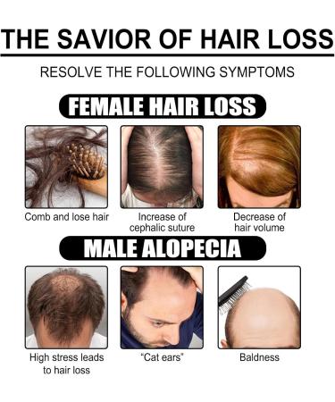 Essential Oils for Hair Growth Frizzy Hair Essential Oil 1 Oz Hydration and Nourishment Hair Growth Essence for Damaged Bleached and Dry - Buy Online on GoSupps.com