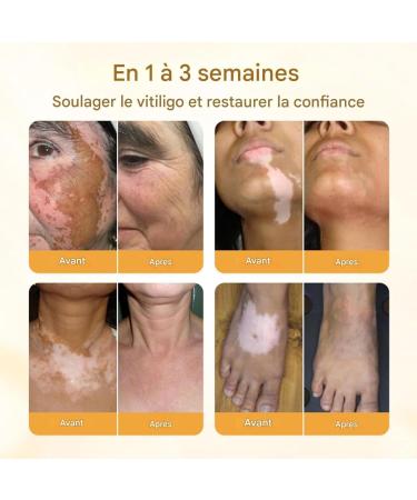 Foot Cream Moisturizing Foot Care - Nourishing and Brightening Plant Extract to Hydrate Dry and Sensitive Skin - Buy Online on GoSupps.com