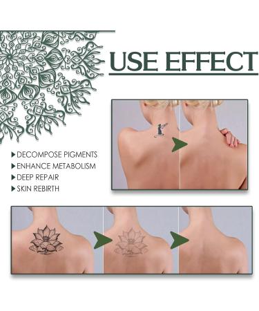 30ml Spray de D tatouage Dissolvant de Pigment de Tatouage Cr me De Retrait De Tatouage D'extrait De Plante Naturelle dissolvant de Tatouage Doux et s r pour la Plupart des Types Gr n - Buy Online on GoSupps.com