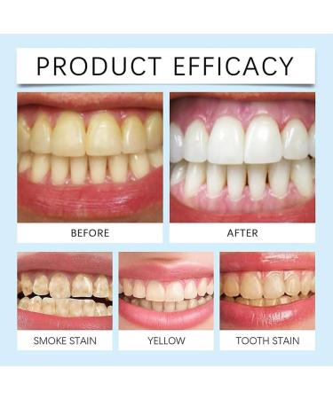 Velverdo Collag ne En Poudre Blanchissante Dents Collagum Blanchiment Dentaire Collagene Poudre Hydroxyapatite Collagum Teeth Whitening Blancheur Dent limination Profonde Des Taches - Buy Online on GoSupps.com