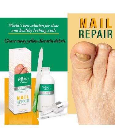Yoffee Clear Nail Repair and Care 60ml - Fungal Nail Treatment with Organic Argan Oil - Made in Spain - Pack of 1 - Buy Online on GoSupps.com