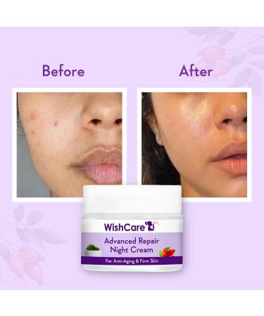 WishCare Collagen Boosting Advance Repair Night Cream With Retinol Niacinamide Grape Seed Sea Algae Jojoba & Rosehip For AntiAging Skin Firming & Plumper Skin 50 gm WARNC50 - Buy Online on GoSupps.com