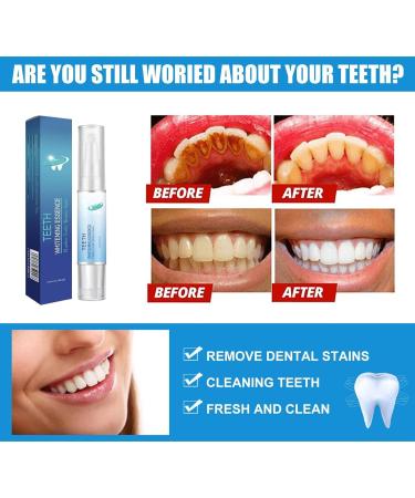 Marshmallow Meadows Teeth Whitening Pen - Fast Effective & Sensitive Teeth Formula - 5PCs Stain Removal - Buy Online on GoSupps.com