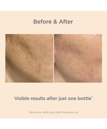 ISDIN Isdinceutics Melaclear Anti-Spot Facial Serum 71% Reduction of Spots and Visible Results in 14 days 30 ml - Buy Online on GoSupps.com