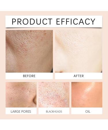 Purifying Exfoliating Gel for Face and Body - Gentle Daily Facial Exfoliator Cleans Dirt Oil Sweat - Oil Free Moisturizing Cleansing Gel for All Skin Types 1.76oz (3) - Buy Online on GoSupps.com