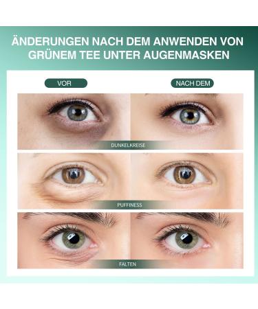 Green Tea Under Eye Patches - 30 Pairs Matcha Eye Mask with Hyaluronic Acid for Dark Circles & Puffiness - Anti-Aging Treatment Gel - Buy Online on GoSupps.com