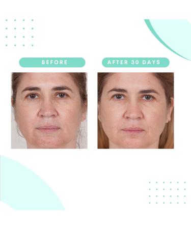 Serious Skincare Glycolic Gommage Extreme Renewal Facial Mask - Micro Exfoliation for Radiant Skin & Decongest Pores - 4.5 oz - Buy Online on GoSupps.com