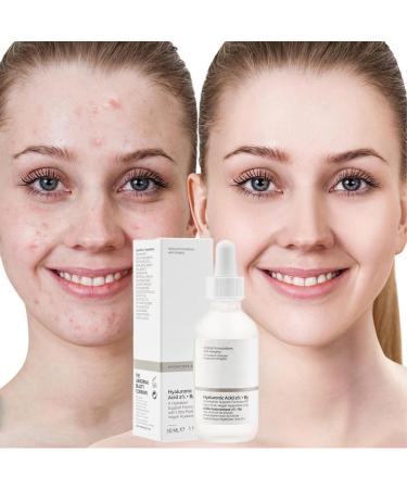 Hyaluronic Acid 2%+B5 Face Serum Hyalu B5 Serum Hydrating Serum Hyaluronic Acid Serum for Face Hyaluronic Acid for Face Hydrated Anti Aging Serum for Face Brightening Serum to Plump and Smooth Skin - Buy Online on GoSupps.com