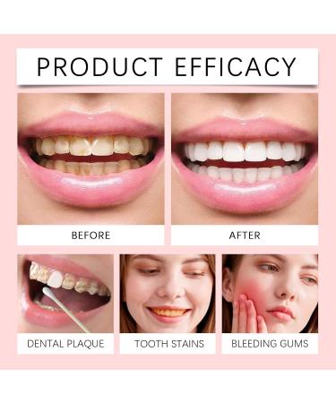 Gentle Cleaning Toothpaste - Removes Teeth Stains & Yellowing Long-Lasting Fresh Breath Daily Oral Care for Bright Teeth(3PCS) - Buy Online on GoSupps.com