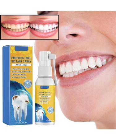 Propolis Oral Instant Treatment Spray - Deep Cleaning & Breath Refreshing Mouthwash | Furzero Propolis Oral Health Spray (1PC) - Buy Online on GoSupps.com