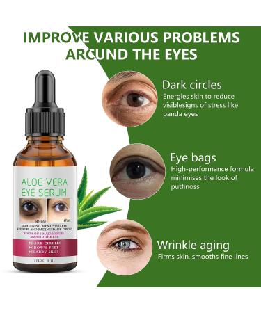 Aloe Vera Anti Aging Eye Serum | Dark Circle & Puffiness Treatment for Women - Buy Online on GoSupps.com